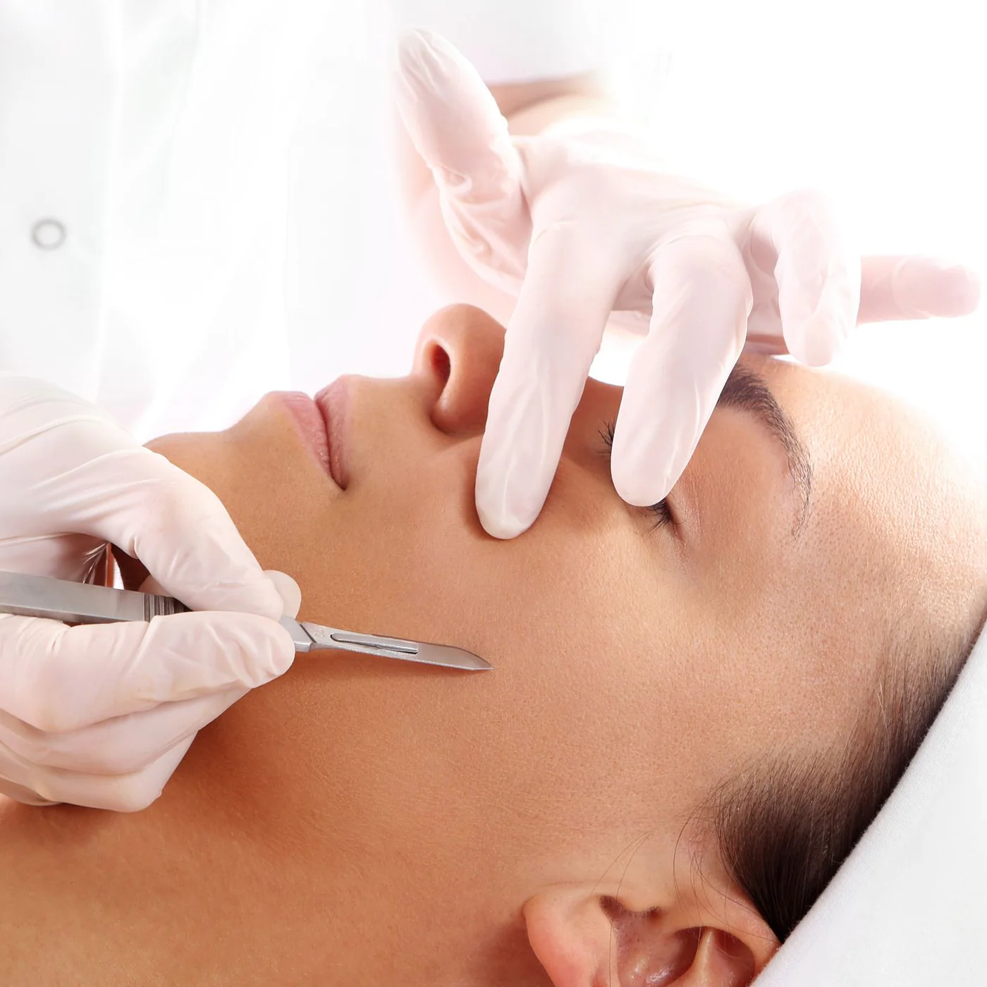 dermaplaning